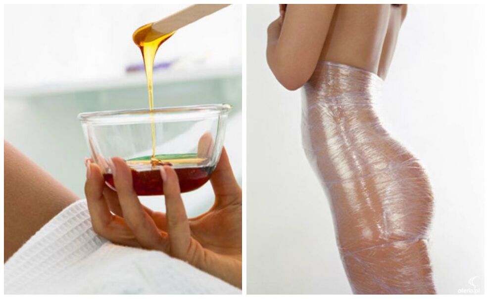 Envolturas corporales para adelgazar